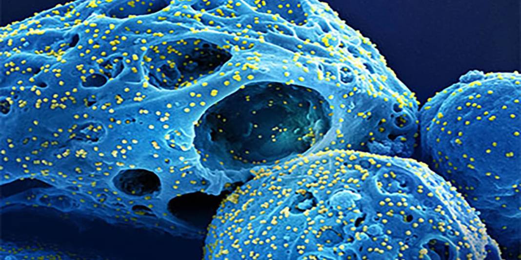 Üç farklı türde ortaya çıkıyor! Konya’da artan salgına karşı uzmandan kritik uyarı 8